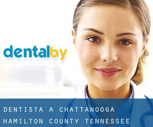 dentista a Chattanooga (Hamilton County, Tennessee)