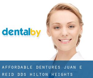 Affordable Dentures: Juan E Reid, DDS (Hilton Heights)