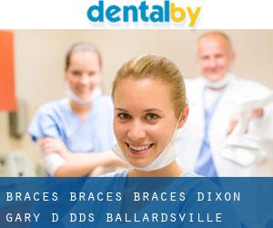 Braces Braces Braces: Dixon Gary D DDS (Ballardsville)