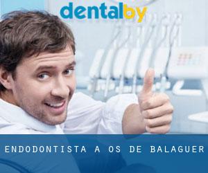 Endodontista a Os de Balaguer