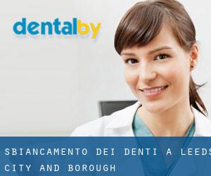 Sbiancamento dei denti a Leeds (City and Borough)