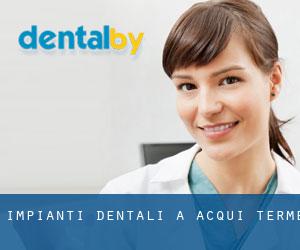 Impianti dentali a Acqui Terme