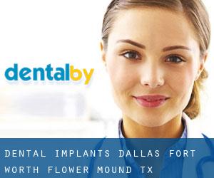 Dental Implants Dallas - Fort Worth, Flower Mound TX